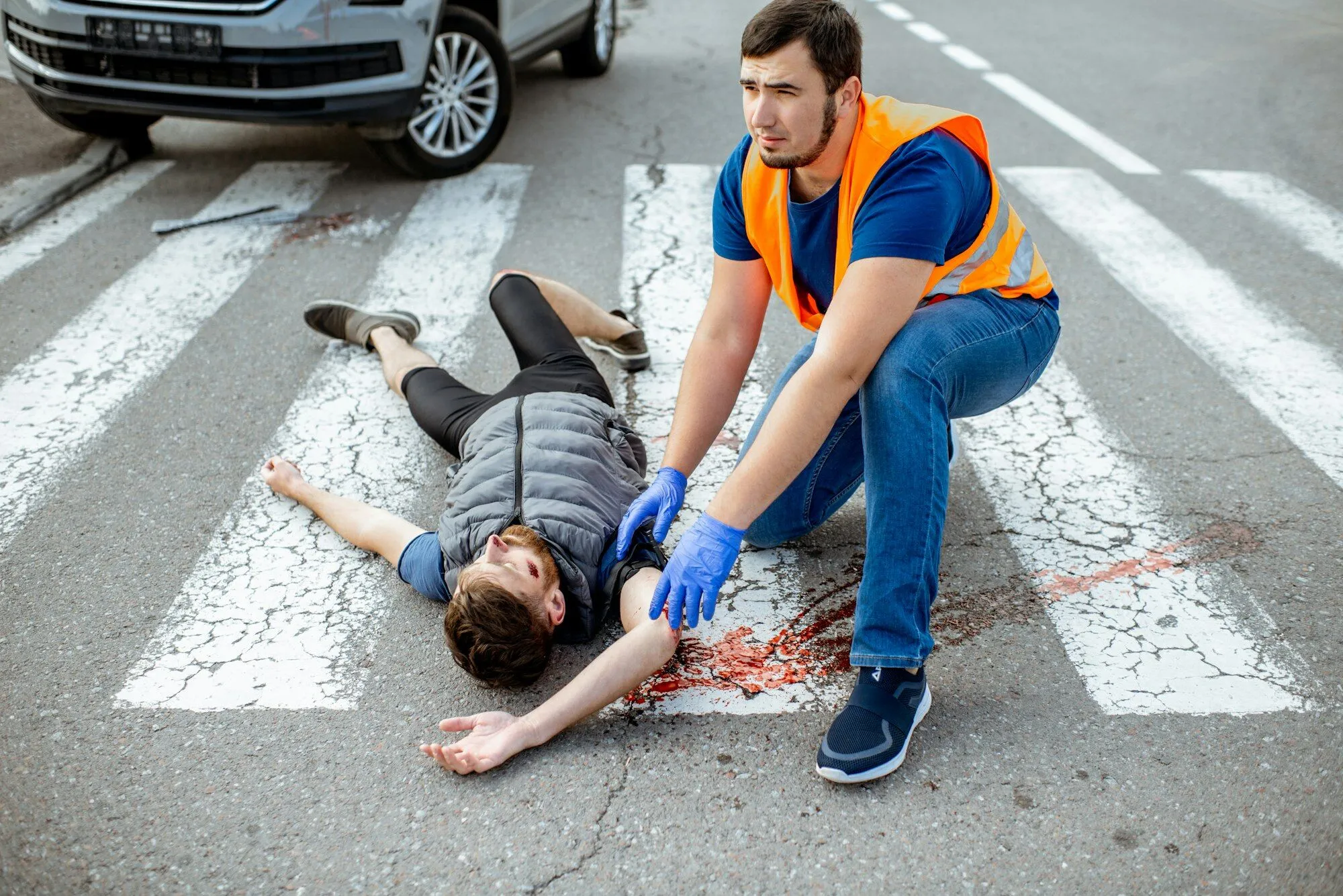 Understanding Your Rights After a Pedestrian Injury in Boulder